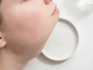 Gevoelige gezichtshuid met subtiele roodheid en een druppel verzachtend serum op witte achtergrond