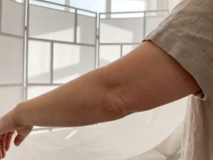 Onderarm en elleboog met subtiele huidtextuur in natuurlijk licht tegen witte medische achtergrond